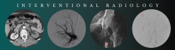CME Science Interventional Radiology Stephen T. Kee, M.D 2021 (Videos)