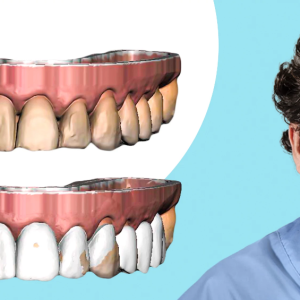 OHI-S The Complete Guide To Digital Dentistry (Videos)