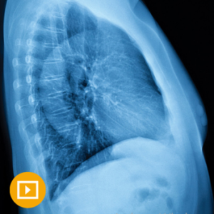 UCSF Thoracic Imaging 2023 (Videos)