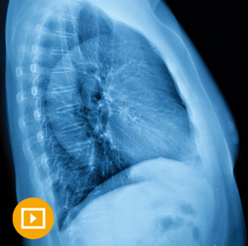 UCSF Thoracic Imaging 2023 (Videos)