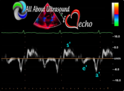 Mastering Left Ventricular Diastology – AllAboutUltrasound 2022 (Complete HTML)