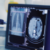 University of Washington Emergency Radiology Review 2023 (Videos)