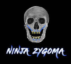 Ninja Zygoma – Implant Ninja (Videos)