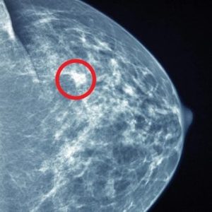 UCSF Breast Imaging 2022 (Videos)