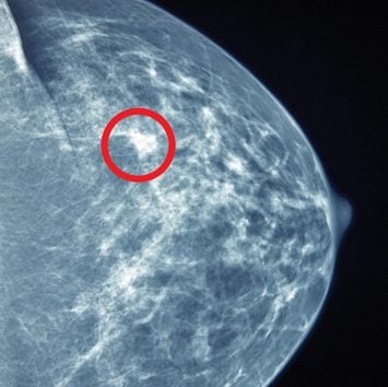 UCSF Breast Imaging 2022 (Videos)