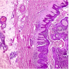 Dermatopathology: Masters of Pathology Series 2025 (Videos + PDF)