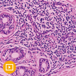 Dermatopathology 2023 (Videos)