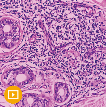 Dermatopathology 2023 (Videos)