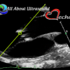 Mastering Aortic Stenosis – AllAboutUltrasound 2022 (Complete HTML)