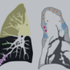 MRIOnline Imaging Mastery Series: Consolidation and Ground Glass 2021 (Videos)