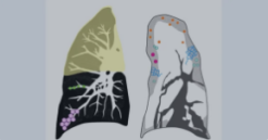 MRIOnline Imaging Mastery Series: Consolidation and Ground Glass 2021 (Videos)