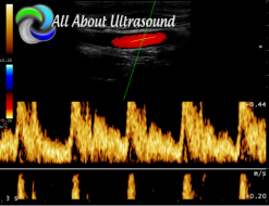 Ultrasound Physics SPI – Registry Review Course – AllAboutUltrasound (Complete HTML)