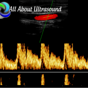 Ultrasound Physics SPI – Registry Review Course – AllAboutUltrasound (Complete HTML)