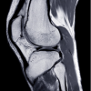 UCSF Neuro and Musculoskeletal Imaging 2022 (Videos)