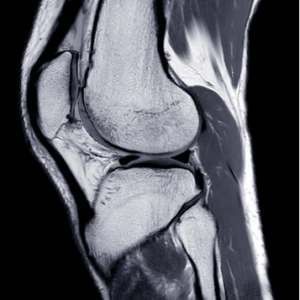 UCSF Neuro and Musculoskeletal Imaging 2022 (Videos)