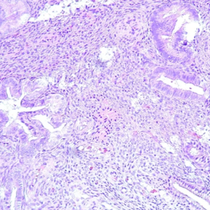 Gynecologic Pathology: Masters of Pathology Series 2026 (Videos + PDF)