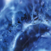 Molecular Diagnostics: Cancer Diagnosis and Patient Management 2021 (Videos)