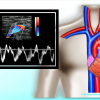 Mastering Upper Extremity Duplex – AllAboutUltrasound (Complete HTML)