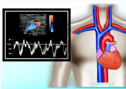 Mastering Upper Extremity Duplex – AllAboutUltrasound (Complete HTML)