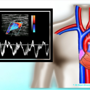 Mastering Upper Extremity Duplex – AllAboutUltrasound (Complete HTML)