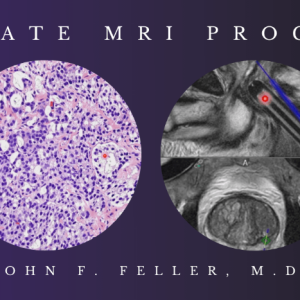 2021 Prostate MRI (Program 1) – John F. Feller, M.D (Videos)