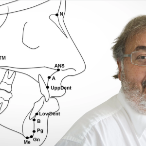 OHI-S Cephalometric Analysis From A to Z Everything a Dentist Should Know 2023 (Videos)