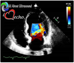 Adult Echocardiography – Test & Learn Registry Review Quiz – AllAboutUltrasound (Complete HTML)