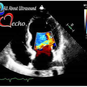 Adult Echocardiography – Test & Learn Registry Review Quiz – AllAboutUltrasound (Complete HTML)