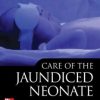 Care of the Jaundiced Neonate (Original PDF from Publisher)