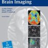 Case-Based Brain Imaging 2nd Edition (Original PDF from Publisher)
