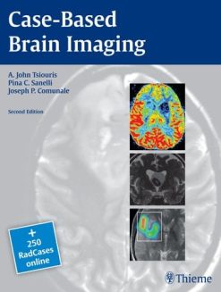 Case-Based Brain Imaging 2nd Edition (Original PDF from Publisher)