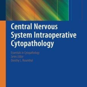 Central Nervous System Intraoperative Cytopathology (Original PDF from Publisher)