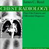 Chest Radiology: Plain Film Patterns and Differential Diagnosed, 6e (Original PDF from Publisher)