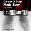 Chest X-Ray Made Easy, 4th Edition