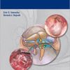 Cholesteatoma (Eirc E. Smouha)
