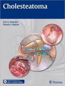 Cholesteatoma (Eirc E. Smouha)