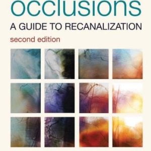 Chronic Total Occlusions: A Guide to Recanalization, 2e (Original PDF from Publisher)