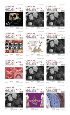 Clinical Oral Implants Research 2022 Full Archives (True PDF)