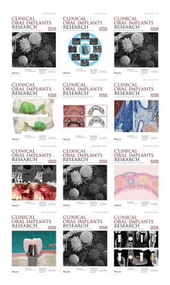 Clinical Oral Implants Research 2023 Full Archives (True PDF)
