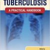 Clinical Tuberculosis: A Practical Handbook (Original PDF from Publisher)