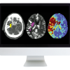 ARRS Code Stroke: What Every Radiologist Should Know 2022 (Videos)