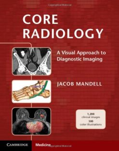 Core Radiology: A Visual Approach to Diagnostic Imaging (Original PDF from Publisher)