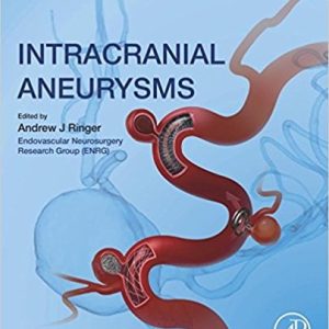 Intracranial Aneurysms 1st Edition (PDF)