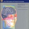 Cranial Neuroimaging and Clinical Neuroanatomy Magnetic Resonance Imaging and Computed Tomography 3rd (Original PDF from Publisher)