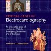 Critical Cases in Electrocardiography: An Annotated Atlas of Don’t-Miss ECGs for Emergency Medicine and Critical Care, 1e (PDF)