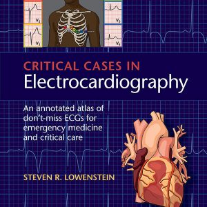 Critical Cases in Electrocardiography: An Annotated Atlas of Don’t-Miss ECGs for Emergency Medicine and Critical Care, 1e (PDF)