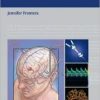Decision Making in Neurocritical Care (Original PDF from Publisher)