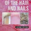 Dermoscopy of the Hair and Nails, Second Edition
