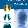 Diagnostic Thoracic Imaging (Original PDF from Publisher)