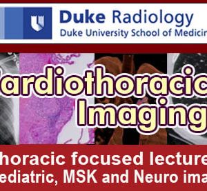 Duke Radiology Cardiothoracic Imaging Plus 2016 (Videos)